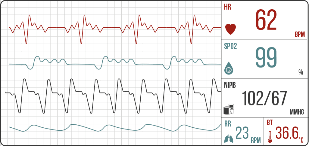 Monitor de constantes vitales: frecuencia, saturación, presión, respiración y temperatura